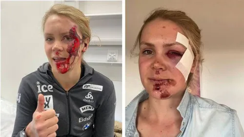 Brutto incidente in bici per Karoline Knotten